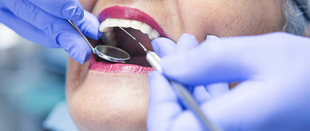 Best Emergency Treatment for Toothache in Boron, CA